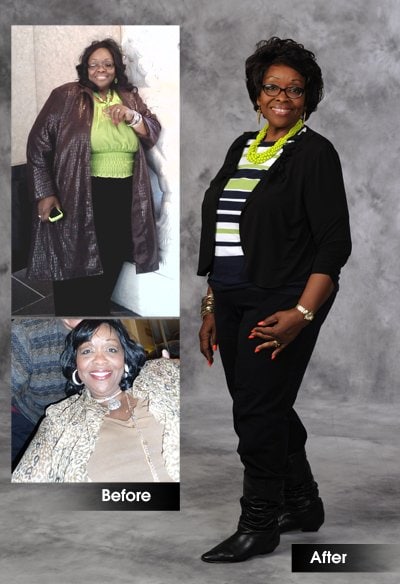 Vivian Foster before and after