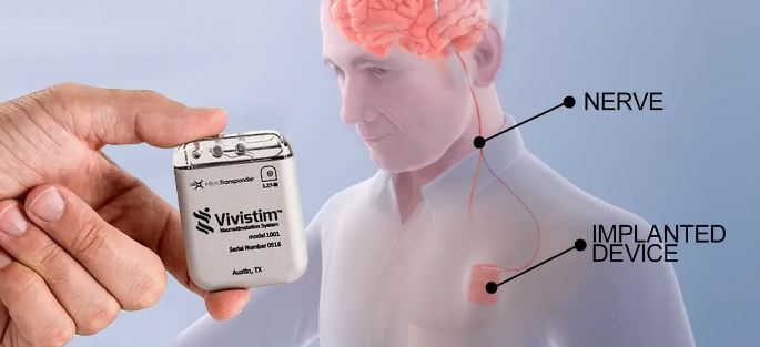 Vivistim